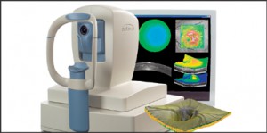 AVANTI  OCT und ANGIOVUE (nicht – invasive Angiographie ohne Kontrastmittel)